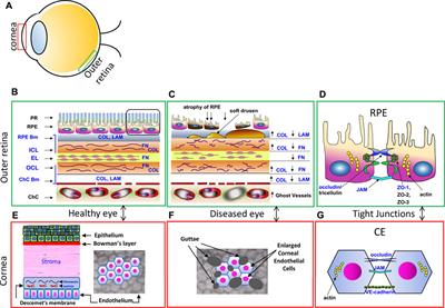 Potential role of extracellular granzyme B in wet age-related macular degeneration and fuchs endothelial corneal dystrophy